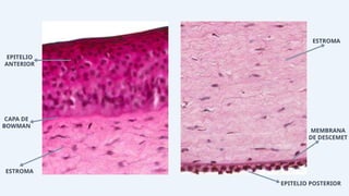 EPITELIO
ANTERIOR
CAPA DE
BOWMAN
ESTROMA
ESTROMA
MEMBRANA
DE DESCEMET
EPITELIO POSTERIOR
 
