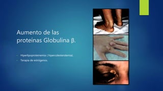 Aumento de las
proteínas Globulina β.
• Hiperlipoproteinemia ( hipercolesterolemia).
• Terapia de estrógenos.
 