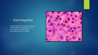 Gammapatías
Las gammapatías son trastornos que se
caracterizan por la presencia de una
concentración muy elevada de
gammaglobulinas en la sangre.
 