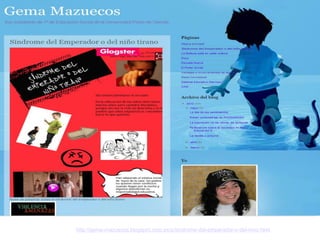 http://gema-mazuecos.blogspot.com.es/p/sindrome-del-emperador-o-del-nino.html

 
