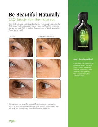 Be Beautiful Naturally
GLO: beauty from the inside out
Agel GLO hydrates, protects and enhances your appearance naturally.
With proper nutrients you can improve your health, which improves
the way you look. GLO is working for thousands of people worldwide.
Could you be next?


 before                               after (4 weeks later)




                                                                           Agel’s Proprietary Blend

                                                                             Grape Seed Oil, Green Tea Oil,
                                                                             Aloe Vera Extract, Horsetail
                                                                             Extract, Green Tea Extract,
                                                                             Lecithin, Tocotrienol, Trace
                                                                             Minerals,Coenzyme Q10,
                                                                      Other Oat Concentrate, Lutein,
                                                                              Ingredientes: Water, Natural Flavoring,
                                                                      Citric Acid, Xanthan Gum, Guar Gum,
  close-up before                     close-up after
                                                                             Tumeric Extract.
                                                                      Sodium Benzoate.




  close-up before                      close-up after




Skin damage can occur for many different reasons — sun, aging,
stress, or environmental pollutants. GLO not only improves the way
you look, but helps protect your skin from the inside out.
 
