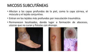 MICOSIS SUBCUTÁNEAS
• Afectan a las capas profundas de la piel, como la capa córnea, el
músculo y el tejido conjuntivo.
• Entran en los tejidos más profundos por inoculación traumática.
• Permanecen localizados, dando lugar a formación de abscesos,
ulceras que no curan y fistulas con drenaje.
 