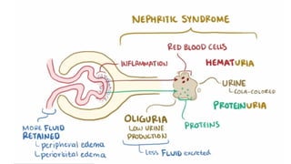Nephrotic & Nephritic Syndromes. Dr. Abhinav Golla , Associate ...