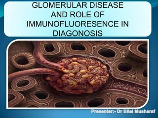 GLOMERULAR DISEASE
     AND ROLE OF
IMMUNOFLUORESENCE IN
     DIAGONOSIS
 