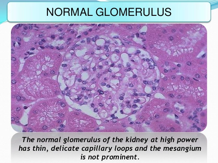Glomerular diseases Glomerular diseases