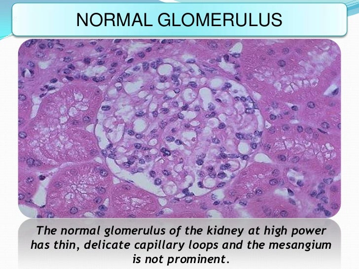 Glomerular diseases