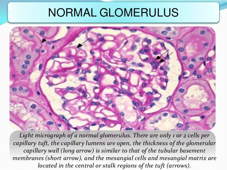 glomerular diseases 12 728