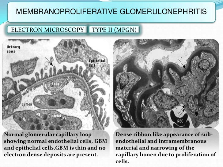 glomerular diseases 64 728
