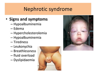 • Signs and symptoms
– Hypoalbuminemia
– Edema
– Hypercholesterolemia
– Hypoalbuminemia
– Tiredness
– Leukonychia
– Breathlessness
– fluid overload
– Dyslipidaemia
Nephrotic syndrome
 
