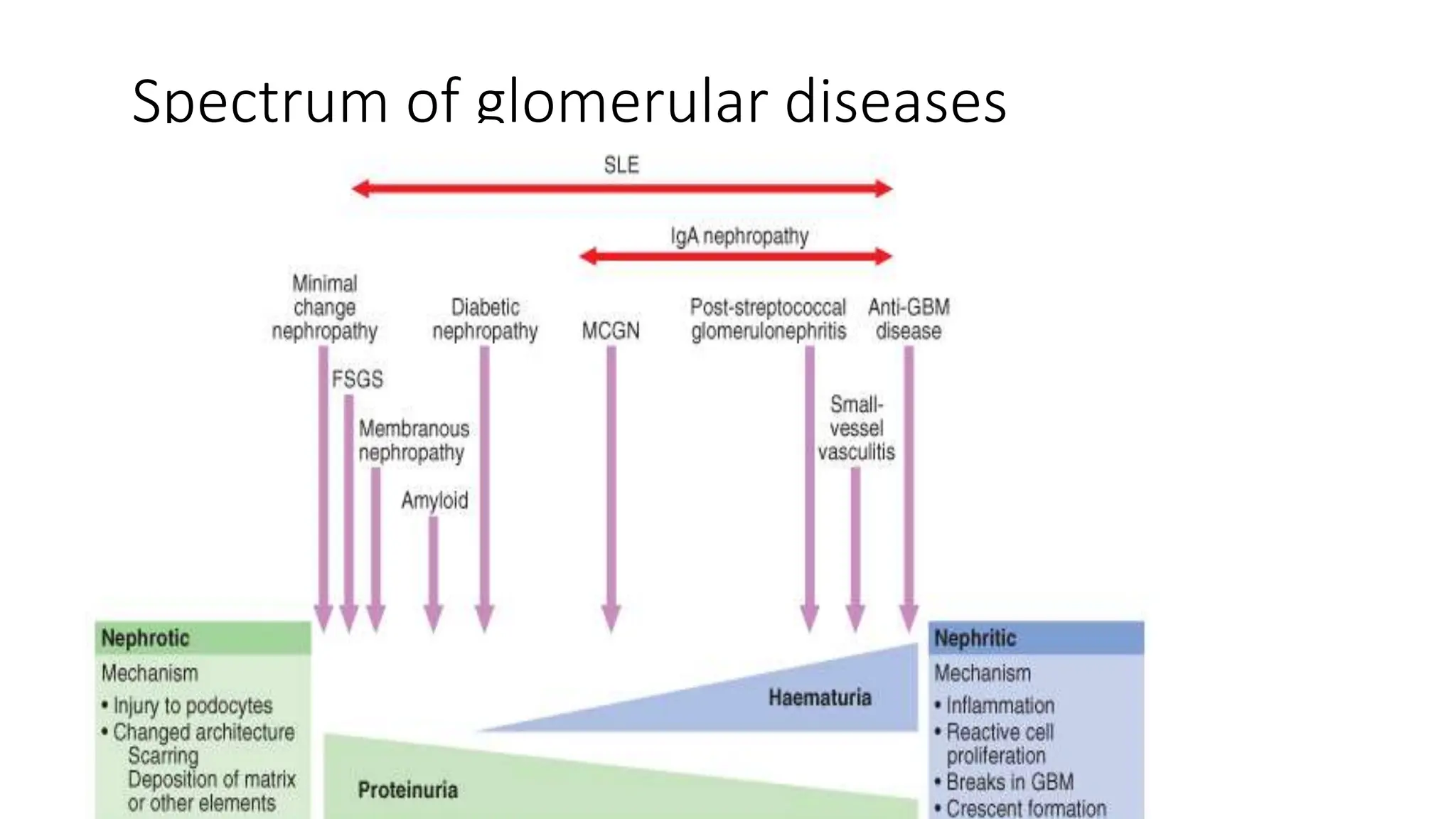 Spectrum of glomerular diseases
 
