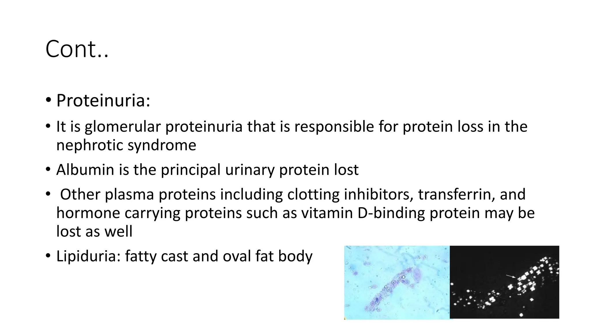 Cont..
• Proteinuria:
• It is glomerular proteinuria that is responsible for protein loss in the
nephrotic syndrome
• Albumin is the principal urinary protein lost
• Other plasma proteins including clotting inhibitors, transferrin, and
hormone carrying proteins such as vitamin D-binding protein may be
lost as well
• Lipiduria: fatty cast and oval fat body
 