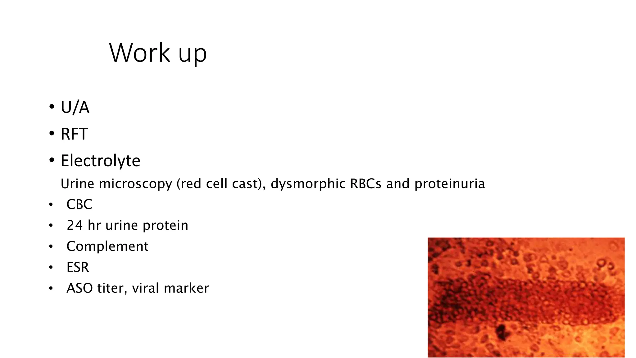 Work up
• U/A
• RFT
• Electrolyte
Urine microscopy (red cell cast), dysmorphic RBCs and proteinuria
• CBC
• 24 hr urine protein
• Complement
• ESR
• ASO titer, viral marker
 