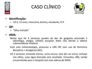 CASO CLÍNICO Identificação: J.O.S, 12 anos, masculino, branco, estudante, O.P. QP:  “ Olho inchado” HMA: Relata que há 3 semanas quadro de dor de garganta associada à odinofagia, otalgia, cefaléia occipital, febre não aferida e edema submandibular bilateral. Com esta sintomatologia, procurou a UPA OP, com uso de Penicilina Benzatina + Analgésico (SIC). Há 2 semanas urinando menos, urina escura, sem dor ao urinar, inchaço nos olhos, usou água boricada sem resultado. Consultou UBS, sendo encaminhado para o Hospital com leve edema de MMII. 