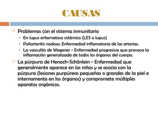 CAUSAS
 Problemas con el sistema inmunitario
• En lupus eritematoso sistémico (LES o lupus)
• Poliarteritis nodosa. Enfermedad inflamatoria de las arterias.
• La vasculitis de Wegener - Enfermedad progresiva que provoca la
inflamación generalizada de todos los órganos del cuerpo.
 La púrpura de Henoch-Schönlein - Enfermedad que
generalmente aparece en los niños y se asocia con la
púrpura (lesiones purpúreas pequeñas o grandes de la piel e
internamente en los órganos) y compromete múltiples
aparatos orgánicos.
 
