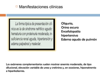  Manifestaciones clínicas
Los exámenes complementarios suelen mostrar anemia moderada, de tipo
dilucional, elevación variable de urea y cretinina y, en ocasiones, hiponatremia
e hiperkaliemia.
Oliguria,
Orina escura
Encefalopatía
hipertensiva
Edema agudo de pulmón
 