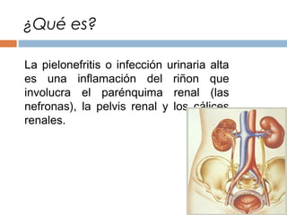 La pielonefritis o infección urinaria alta
es una inflamación del riñon que
involucra el parénquima renal (las
nefronas), la pelvis renal y los cálices
renales.
¿Qué es?
 