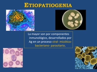 ETIOPATIOGENIA



 La mayor son por componentes
  inmunológico, desarrollados por
  Ag en un proceso viral- micótico-
      bacteriano- parasitario.
 