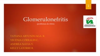 Glomerulonefritis
(problemas de riñón)
TATIANA ARTUNDUAGA R.
YECENIA CORRALES C.
ANDREA NAVIA V.
KELLY LATORRE R.
1
 