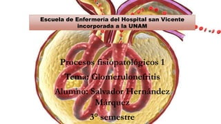 Escuela de Enfermería del Hospital san Vicente
incorporada a la UNAM
Procesos fisiopatológicos 1
Tema: Glomerulonefritis
Alumno: Salvador Hernández
Márquez
3° semestre
 