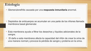 Etiología
• Glomerulonefritis causada por una respuesta inmunitaria anormal.
• Depósitos de anticuerpos se acumulan en una parte de los riñones llamada
membrana basal glomerular.
• Esta membrana ayuda a filtrar los desechos y líquidos adicionales de la
sangre.
• El daño a esta membrana afecta la capacidad del riñón de crear la orina de
una manera normal y provoca la pérdida de sangre y proteína en la orina.
 