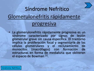 Síndrome Nefrítico
     Glomerulonefritis rápidamente
              progresiva
      • La glomerulonefritis rápidamente progresiva es un
        síndrome caracterizado por signos de lesión
        glomerular grave sin causa específica. El trastorno
        implica la proliferación focal y segmentaria de las
        células glomerulares y el reclutamiento de
        monocitos (macrófagos) con formación de
        estructuras en forma de medialuna que obliteran
        el espacio de Bowman [1].


Síndrome Nefrítico          eduardo5456 - 2013                14
 