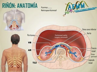 T12
AR
VR
Aorta
Vena cava inferior
Peritoneo
capsula
renal
Grasa
perirenal
Fascia
renal
RIÑÓN: ANATOMÍA Forma:…….
Retroperitoneal
T12
T12
 