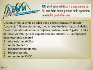 Rpta: C
Una mujer de 16 años de edad tiene diuresis escasas y de color
“coca-cola”. Nueve días antes, tuvo un cuadro de faringoamigdalitis.
En el sistemático de orina se objetiva proteinuria de 2 g/día. La TA es
de 180/120 mmHg. En la exploración hay edemas. ¿Qué esperaría
encontrar en la sangre?
A. Alcalosis metabólica.
B. Aumento de LDH.
C. Hipocomplementemia.
D. Hipopotasemia.
E. Aumento del CH5O.
R!! síndrome nefrítico + antecedente de
FA nos debe hacer pensar en la aparición
de una GN postinfecciosa
 