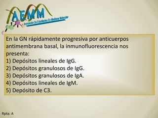 Rpta: A
En la GN rápidamente progresiva por anticuerpos
antimembrana basal, la inmunofluorescencia nos
presenta:
1) Depósitos lineales de IgG.
2) Depósitos granulosos de IgG.
3) Depósitos granulosos de IgA.
4) Depósitos lineales de IgM.
5) Depósito de C3.
 