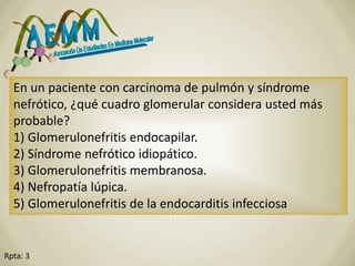Rpta: 3
En un paciente con carcinoma de pulmón y síndrome
nefrótico, ¿qué cuadro glomerular considera usted más
probable?
1) Glomerulonefritis endocapilar.
2) Síndrome nefrótico idiopático.
3) Glomerulonefritis membranosa.
4) Nefropatía lúpica.
5) Glomerulonefritis de la endocarditis infecciosa
 