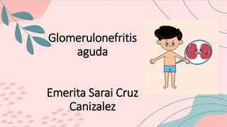 Glomerulonefritis
aguda
Emerita Sarai Cruz
Canizalez
 