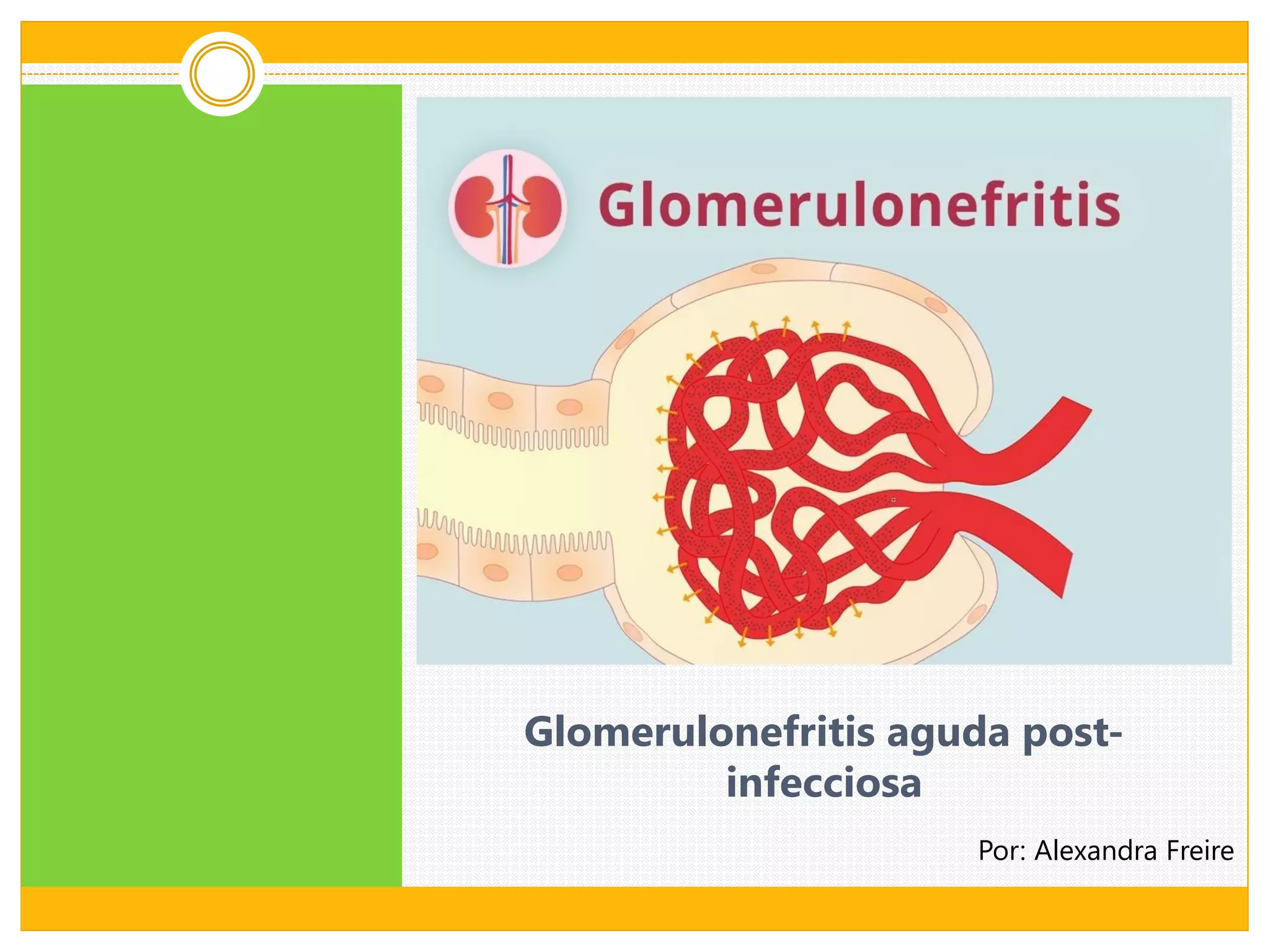 Glomerulonefritis aguda post infecciosa | PDF