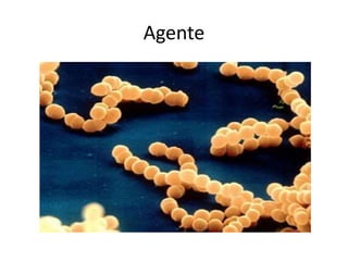 Agente 
 