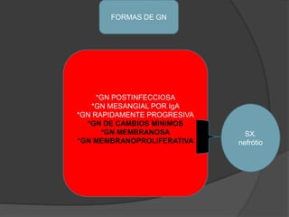 FORMAS DE GN*GN POSTINFECCIOSA*GN MESANGIAL POR IgA*GN RAPIDAMENTE PROGRESIVA*GN DE CAMBIOS MINIMOS*GN MEMBRANOSA*GN MEMBRANOPROLIFERATIVASX. nefrótio