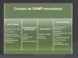 Hematuria recurrente