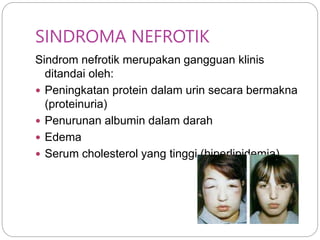 glomerulonefritis_k6_ppt.ppt