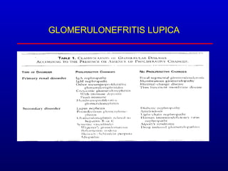 GLOMERULONEFRITIS LUPICA
 