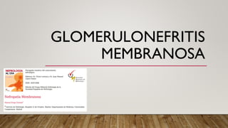 GLOMERULONEFRITIS
MEMBRANOSA
 