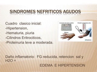 Cuadro clasico inicial:
-Hipertension,
-Hematuria, piuria
-Cilindros Eritrociticos,
-Proteinuria leve a moderada.
Daño inflamatorio: FG reducida, retencion sal y
H2O =
EDEMA E HIPERTENSION
SINDROMES NEFRITICOS AGUDOS
 