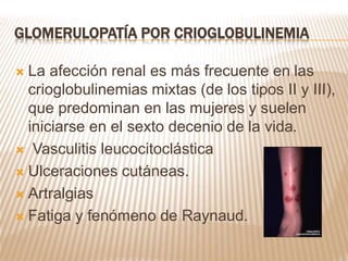 GLOMERULOPATÍA POR CRIOGLOBULINEMIA
 La afección renal es más frecuente en las
crioglobulinemias mixtas (de los tipos II y III),
que predominan en las mujeres y suelen
iniciarse en el sexto decenio de la vida.
 Vasculitis leucocitoclástica
 Ulceraciones cutáneas.
 Artralgias
 Fatiga y fenómeno de Raynaud.
 