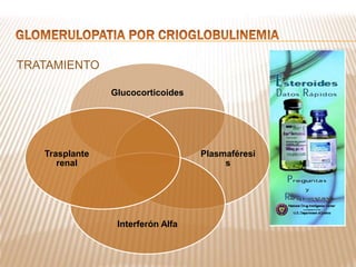TRATAMIENTO
Glucocorticoides
Plasmaféresi
s
Interferón Alfa
Trasplante
renal
 