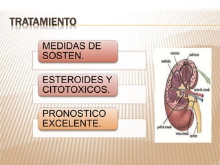 TRATAMIENTO
MEDIDAS DE
SOSTEN.
ESTEROIDES Y
CITOTOXICOS.
PRONOSTICO
EXCELENTE.
 