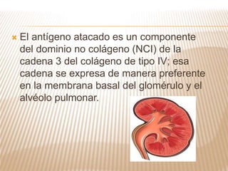  El antígeno atacado es un componente
del dominio no colágeno (NCI) de la
cadena 3 del colágeno de tipo IV; esa
cadena se expresa de manera preferente
en la membrana basal del glomérulo y el
alvéolo pulmonar.
 