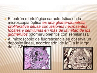  El patrón morfológico característico en la
microscopia óptica es una glomerulonefritis
proliferativa difusa con lesiones necrosantes
focales y semilunas en más de la mitad de los
glomérulos (glomerulonefritis con semilunas).
 Al microscopio de fluorescencia se observa un
depósito lineal, acordonado, de IgG a lo largo
de la GBM.
 