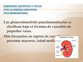 Las glomerulonefritis pauciinmunitarias se
clasifican bajo el término de vasculitis de
pequeños vasos.
Más frecuentes en sujetos de raza blanca y
personas mayores. (edad media 57 años)
 