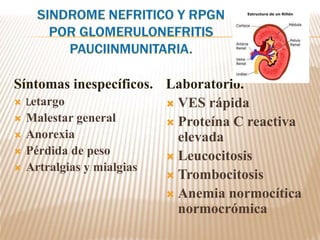 Síntomas inespecíficos.
 Letargo
 Malestar general
 Anorexia
 Pérdida de peso
 Artralgias y mialgias
Laboratorio.
 VES rápida
 Proteína C reactiva
elevada
 Leucocitosis
 Trombocitosis
 Anemia normocítica
normocrómica
 