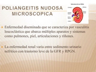  Enfermedad diseminada que se caracteriza por vasculitis
leucoclástica que abarca múltiples aparatos y sistemas
como pulmones, piel, articulaciones y riñones.
 La enfermedad renal varia entre sedimento urinario
nefrítico con trastorno leve de la GFR y RPGN.
 