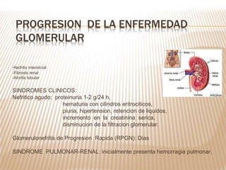 -Nefritis intersticial
-Fibrosis renal
-Atrofia tubular
SINDROMES CLINICOS:
Nefritico agudo: proteinuria 1-2 g/24 h,
hematuria con cilindros eritrociticos,
piuria, hipertension, retencion de liquidos,
incremento en la creatinina serica,
disminucion de la filtracion glomerular.
Glomerulonefritis de Progresion Rapida (RPGN): Dias
SINDROME PULMONAR-RENAL: inicialmente presenta hemorragia pulmonar.
PROGRESION DE LA ENFERMEDAD
GLOMERULAR
 