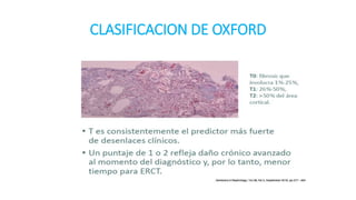 Glomerulonefritis Por Ig A PPTX glomerulonefritis-por-ig-a-pptx