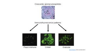 Semin Nephrol. 2011 Jul;31(4):361-8
 