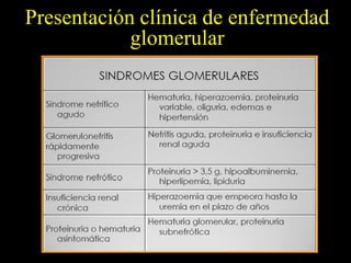 Presentación clínica de enfermedad
            glomerular
 